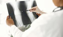 Diagnostyczne badania radiologiczne (badania RTG)